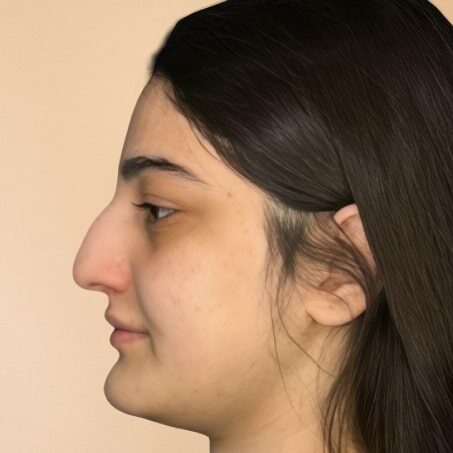 Öncə