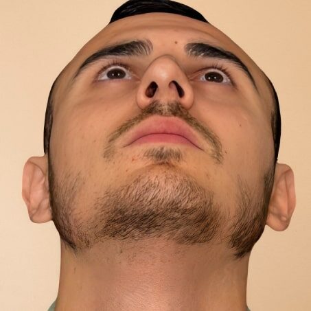 Nəticə 19 — öncə