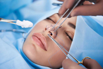 Rinoplastika