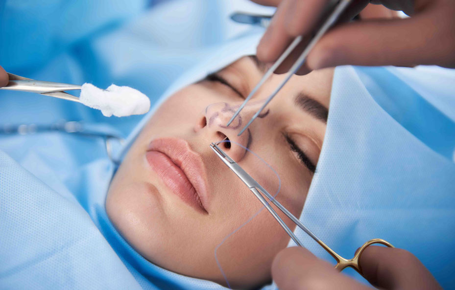 Rinoplastika